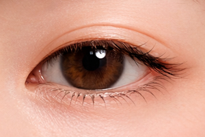 선천성 안검하수