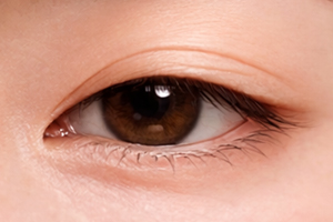 후천성 안검하수